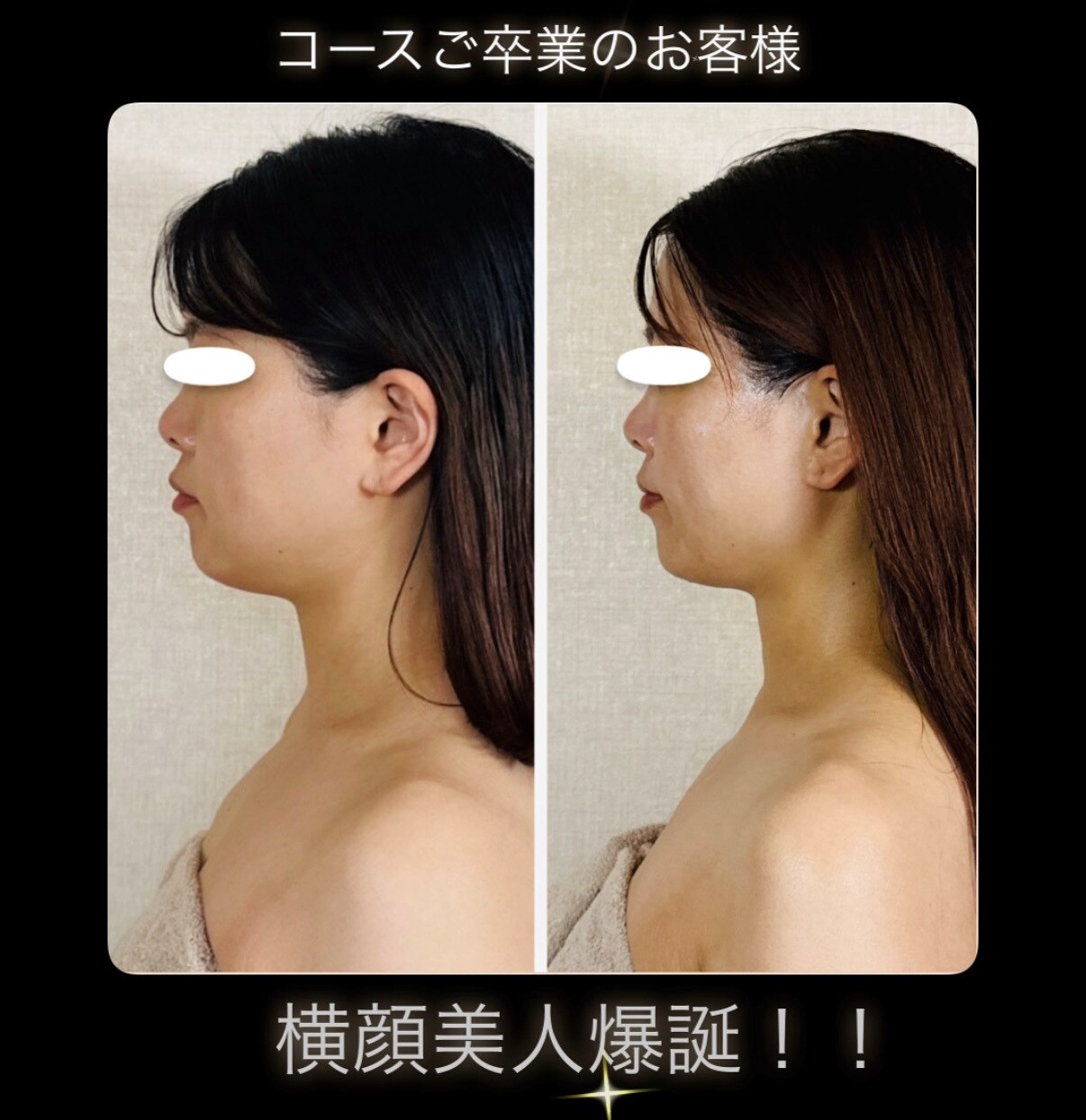 施術室の雰囲気