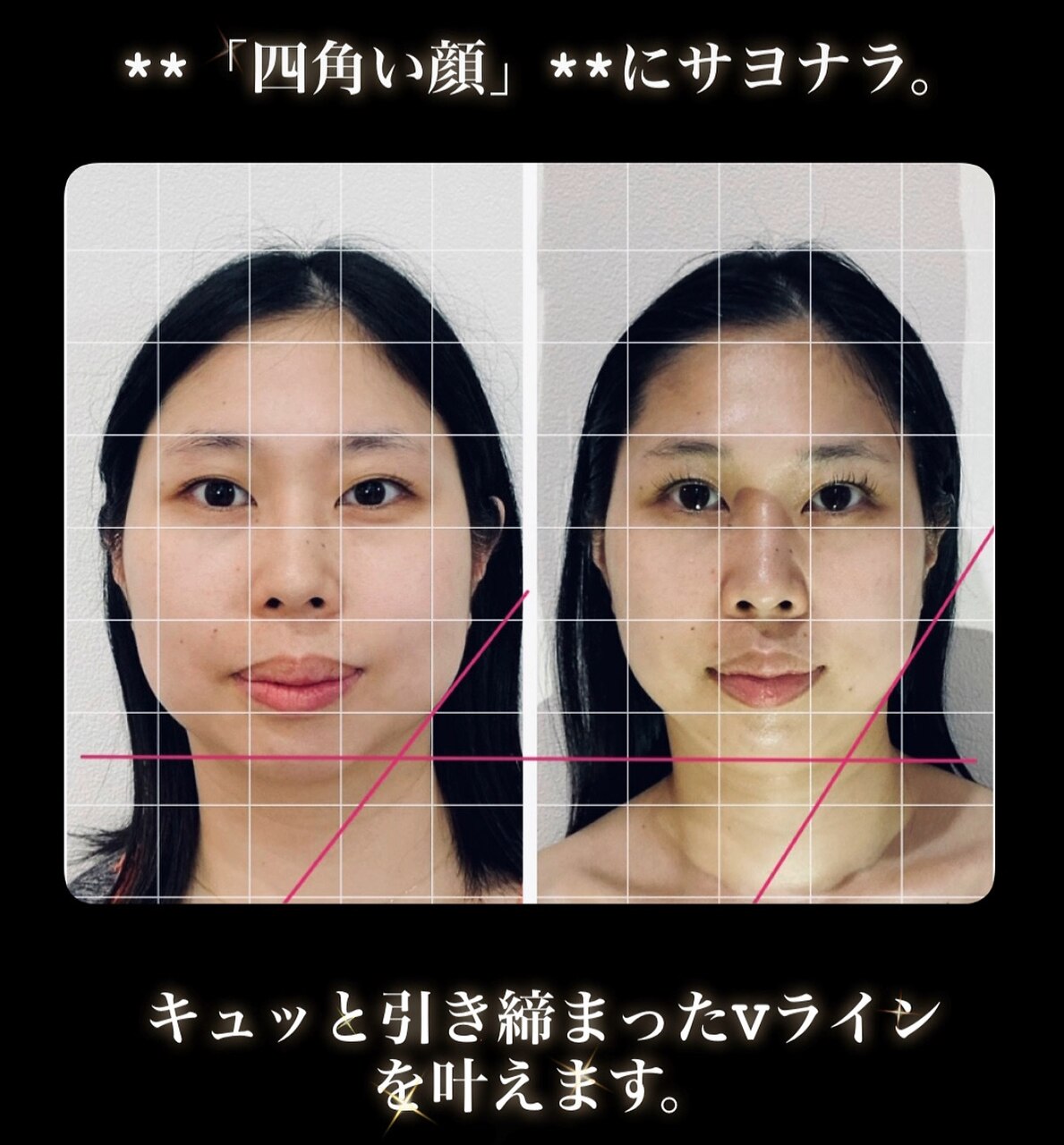 真美(Sinbi)の施術アイテム