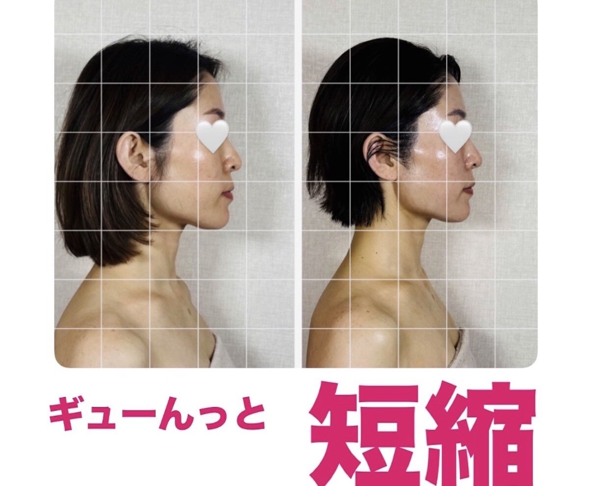 毛穴洗浄（ハイドラフェイシャル）ヘッド付　¥5,500