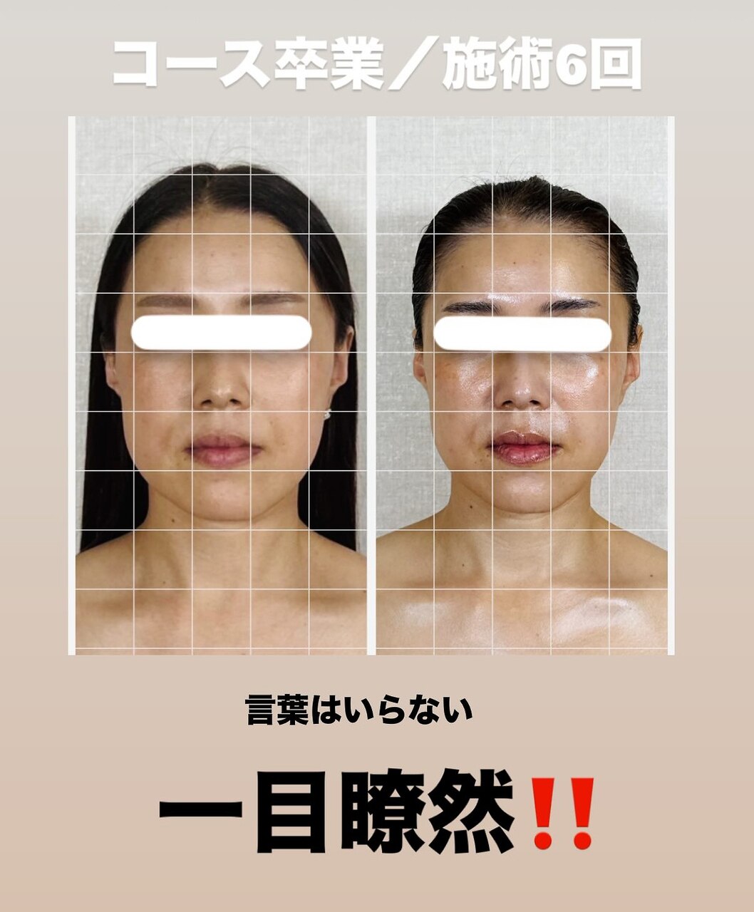 高濃度炭酸泡洗顔